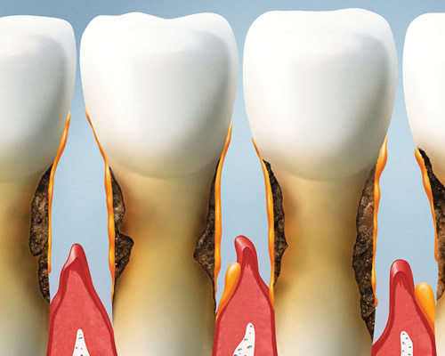 periodontology